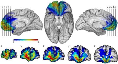 Ventromedial Prefrontal Cortex Is Critical for Helping Others Who Are Suffering